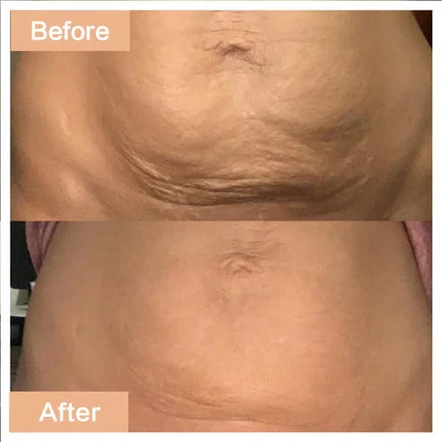 Age-Defying Revival Collagen Body Oil