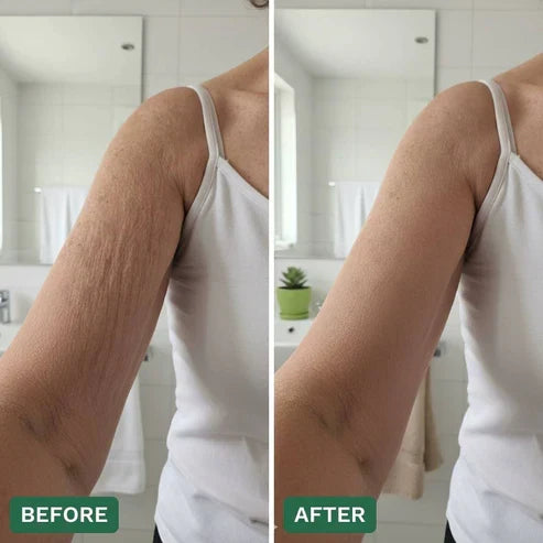 Crepey Skin Repair Cream