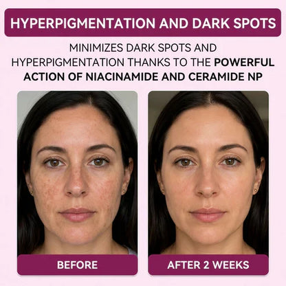 Regenerating Mask with Hydrolyzed Collagen and Niacinamide