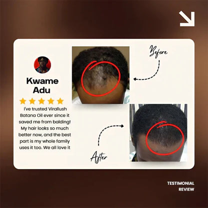 Batana Natural Hair Growth Oil 2.0