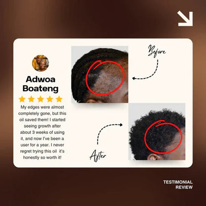 Batana Natural Hair Growth Oil 2.0