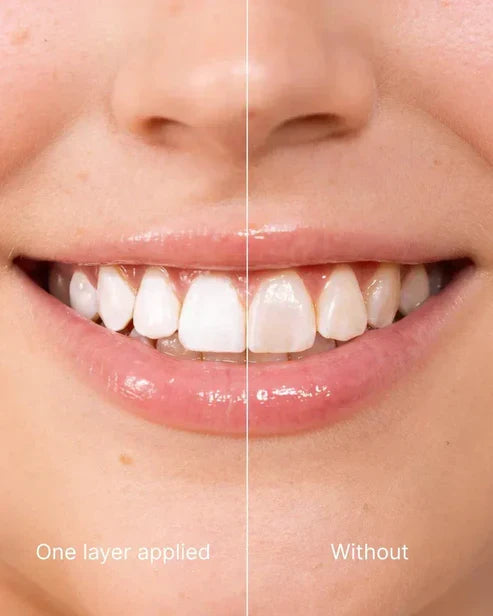 Tooth Polish