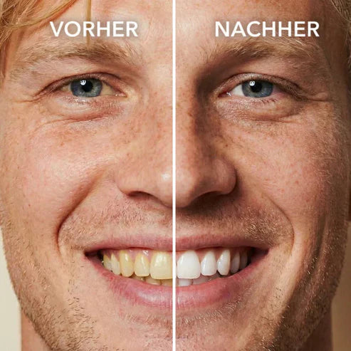 Tooth Polish