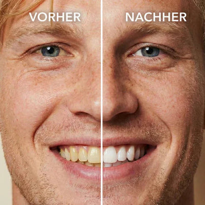 Tooth Polish