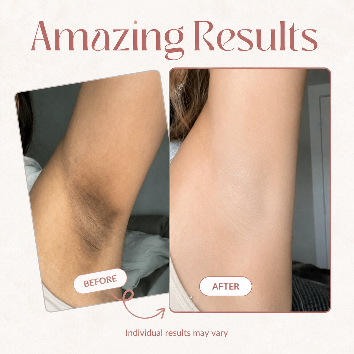 Cradelia Brightening Body Peel Spray