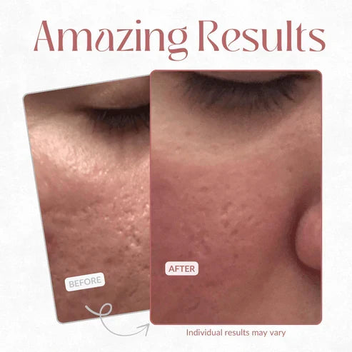 ✨CACTOX Pore Relief Multi Balm