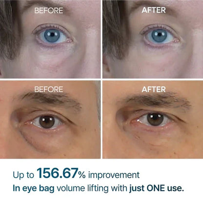 Eyebag Remover Cream