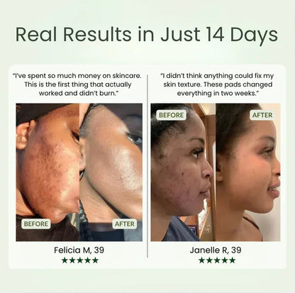 Dark Spot Corrector Pads for Face | Korean Toner Pads for Hyperpigmentation