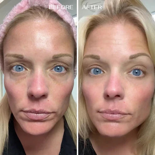 ALL-IN-ONE BALM FOR UNDER EYE RENEWAL✨