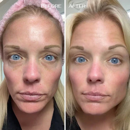 ALL-IN-ONE BALM FOR UNDER EYE RENEWAL✨