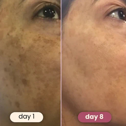 Brightening turmeric & kojic acid pads
